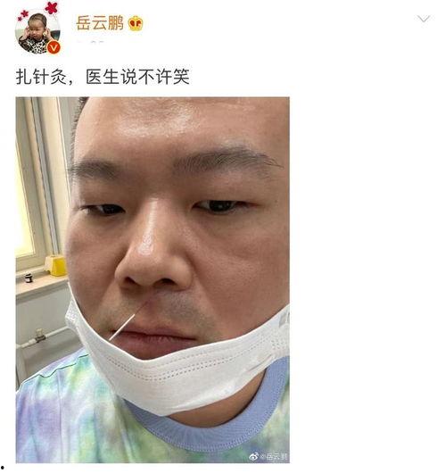 搞笑 针灸,笑料百出，健康生活新体验